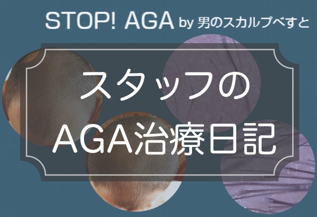経過画像｜AGA治療ブログ【1ヶ月目～3ヶ月目】