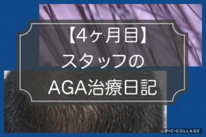 【4ヶ月目】AGA治療の経過ブログ