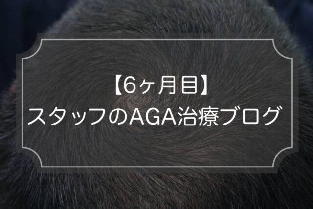 【6ヶ月目】スタッフのAGA治療ブログ