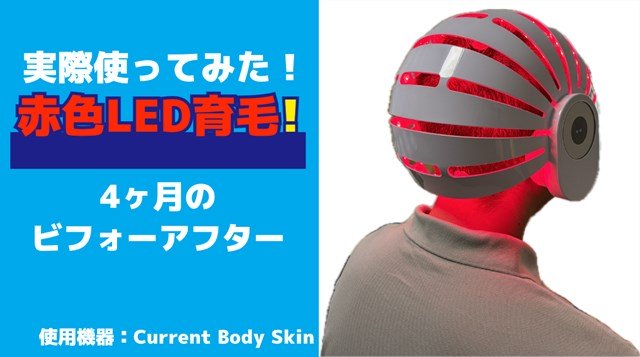 【長期テスト】赤色LEDの育毛効果について!CurrentBody使用レビュー